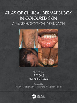 cover image of Atlas of Clinical Dermatology in Coloured Skin